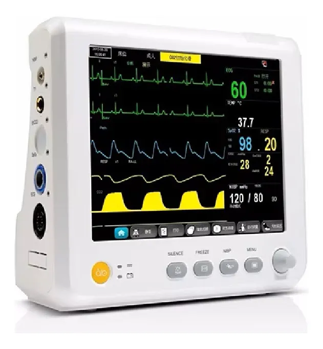 Monitor Cardíaco Multiparamétrico – Alta Precisão para Monitoramento Intensivo